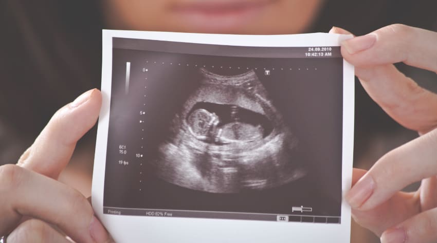 Pregnant mother holding a photo of her ultrasound scan close to her baby bump